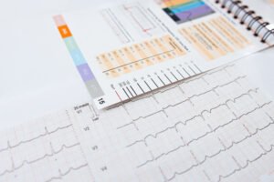 EKG-Lineal